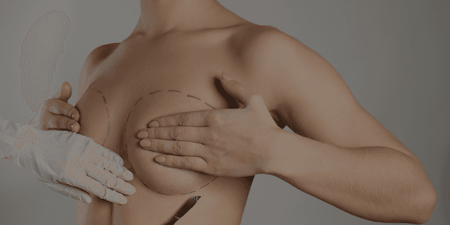 Breast Augmentation