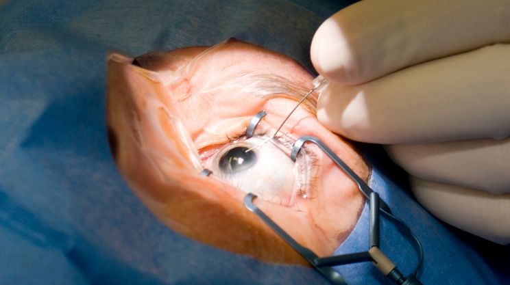 Phacoemulsification, Cataract_Surgery