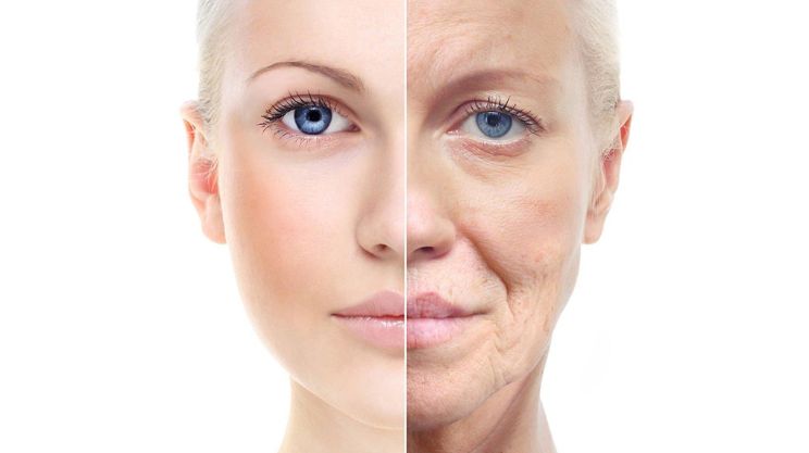 facelift Rhytidectomy
