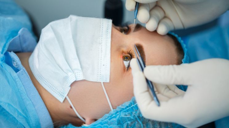 Glaucoma_Surgery, Trabeculectomy (or Minimally Invasive Glaucoma Surgery – MIGS)