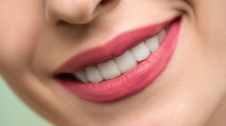 Hollywood_Smile, Full_Mouth_Reconstruction