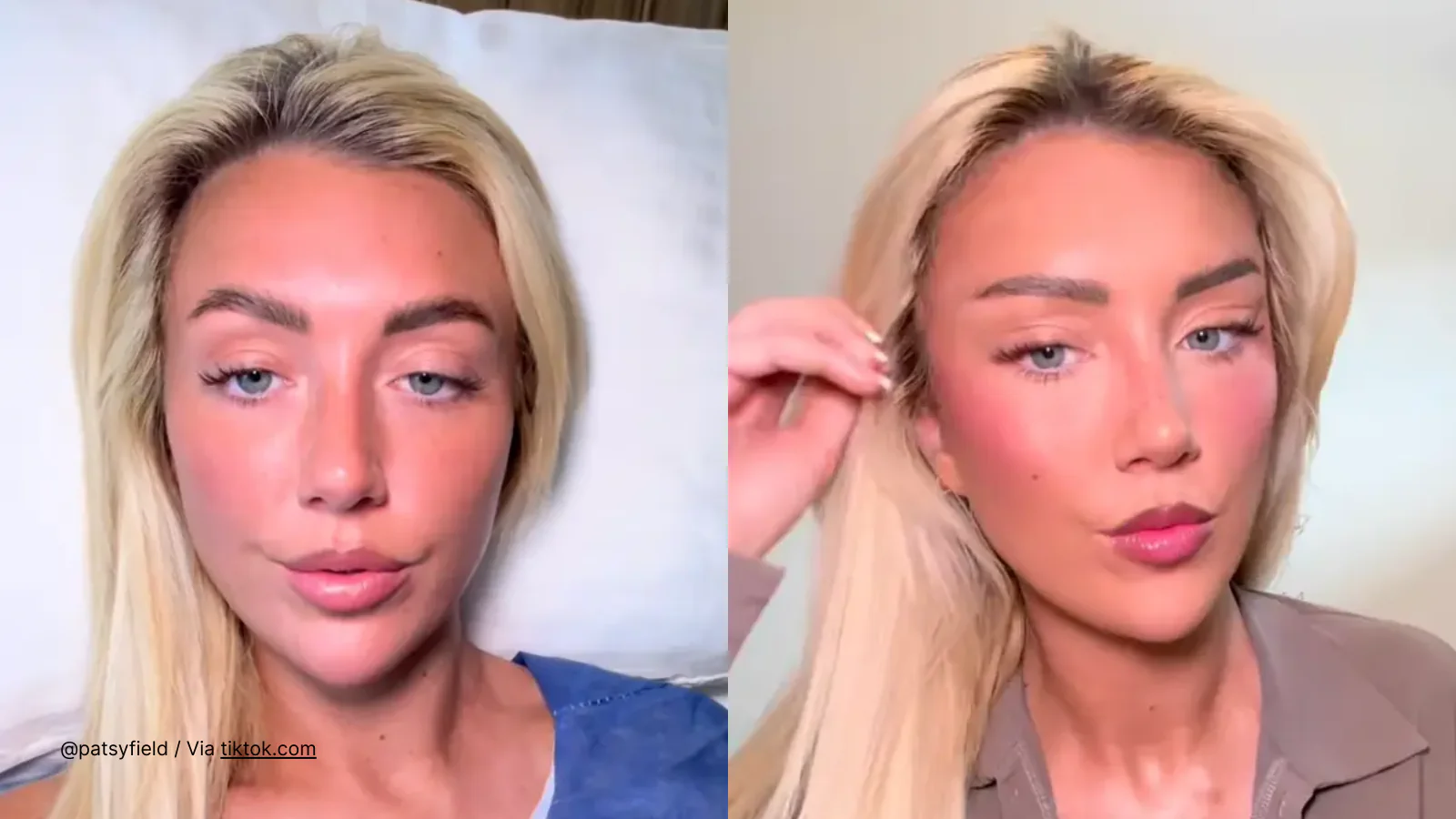 Patsy’s Fox Eye Surgery Story