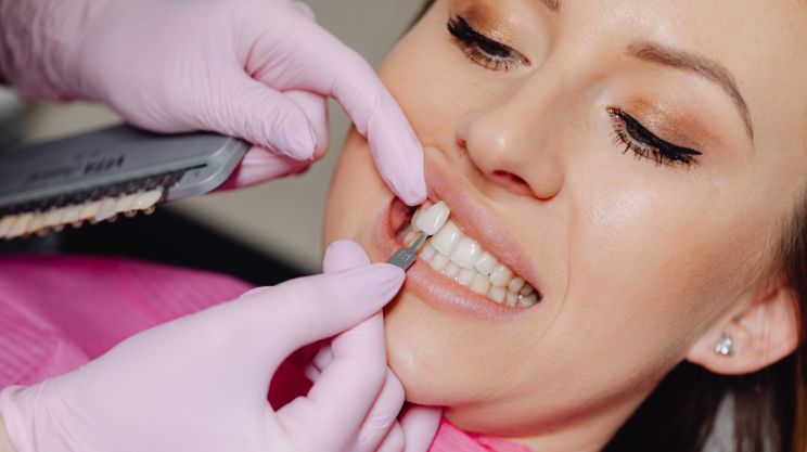Porcelain Veneers