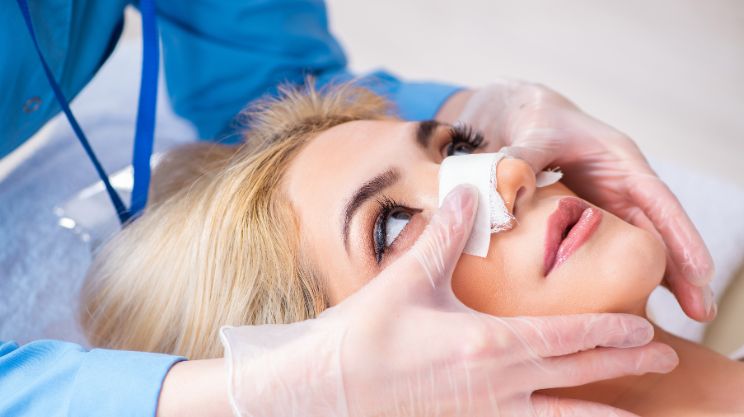 Rhinoplasty nose_job