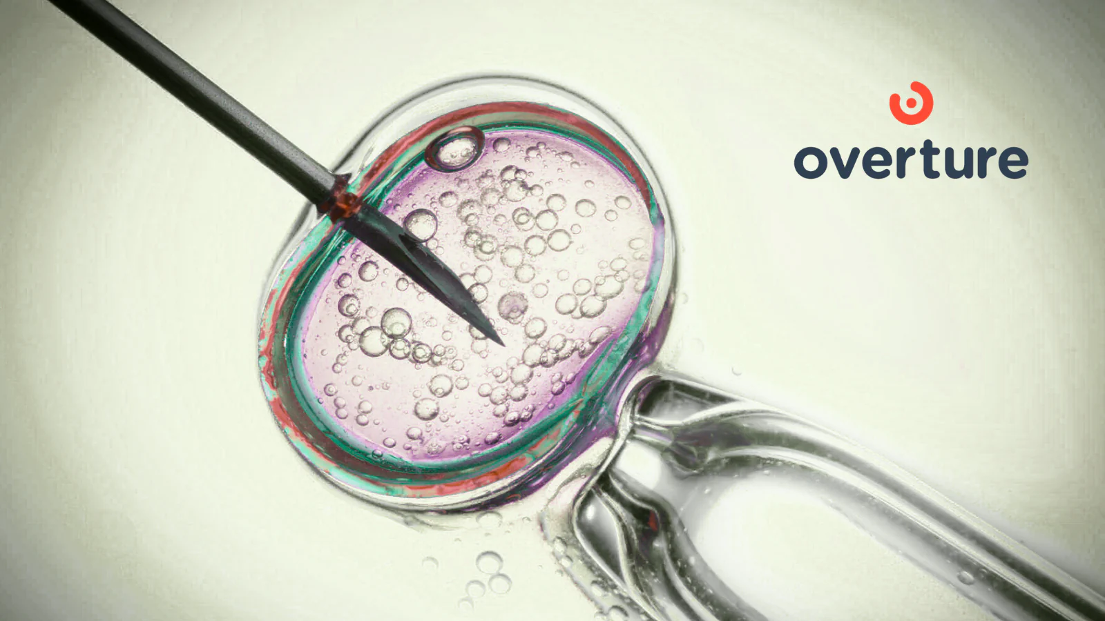 Overture New IVF Technology