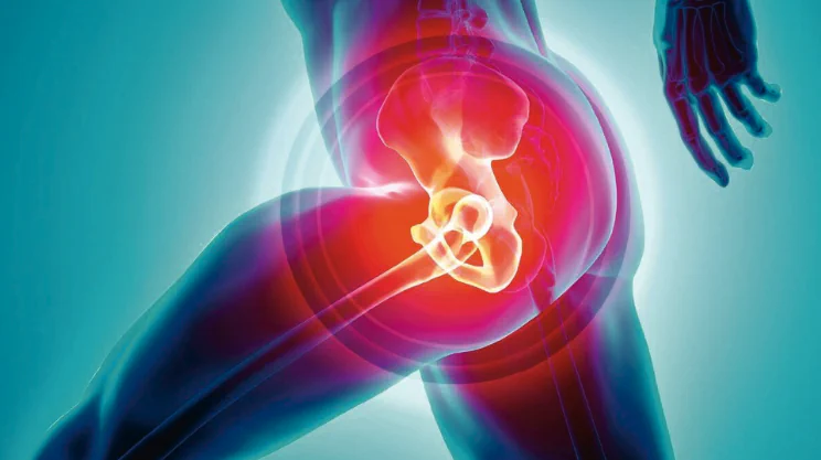 Total Hip Surgery in FlytoDoc